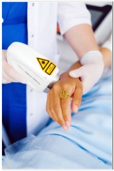 사마귀 제거방법