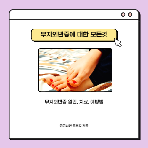 발