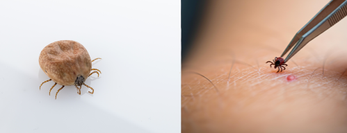 집진드기(왼쪽)와 참진드기(오른쪽)