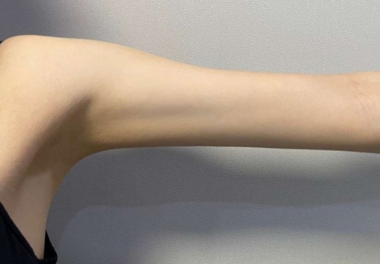 휴그랩 리즈라인 후기