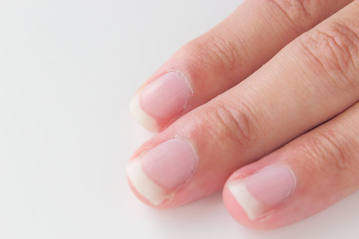 손톱에 세로줄이 생기는 이유 알아보기 : 원인 및 관리방법 