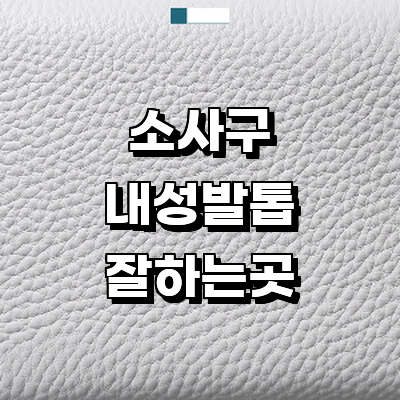 부천 소사구 내성발톱