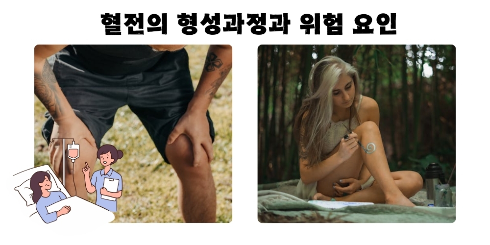 혈전-다리경련-12