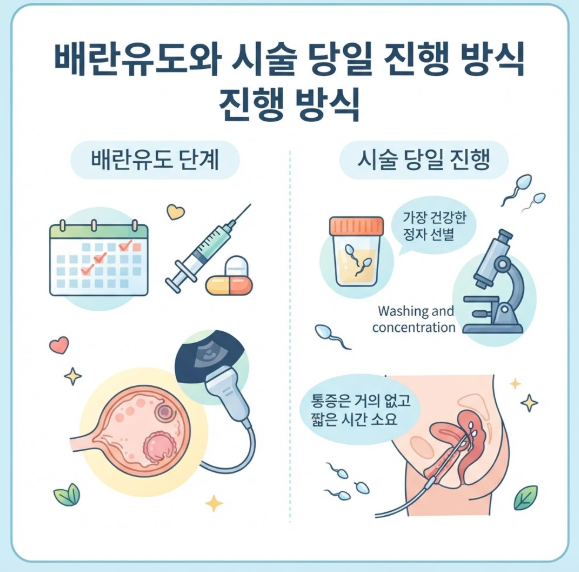 난임 시술 과정