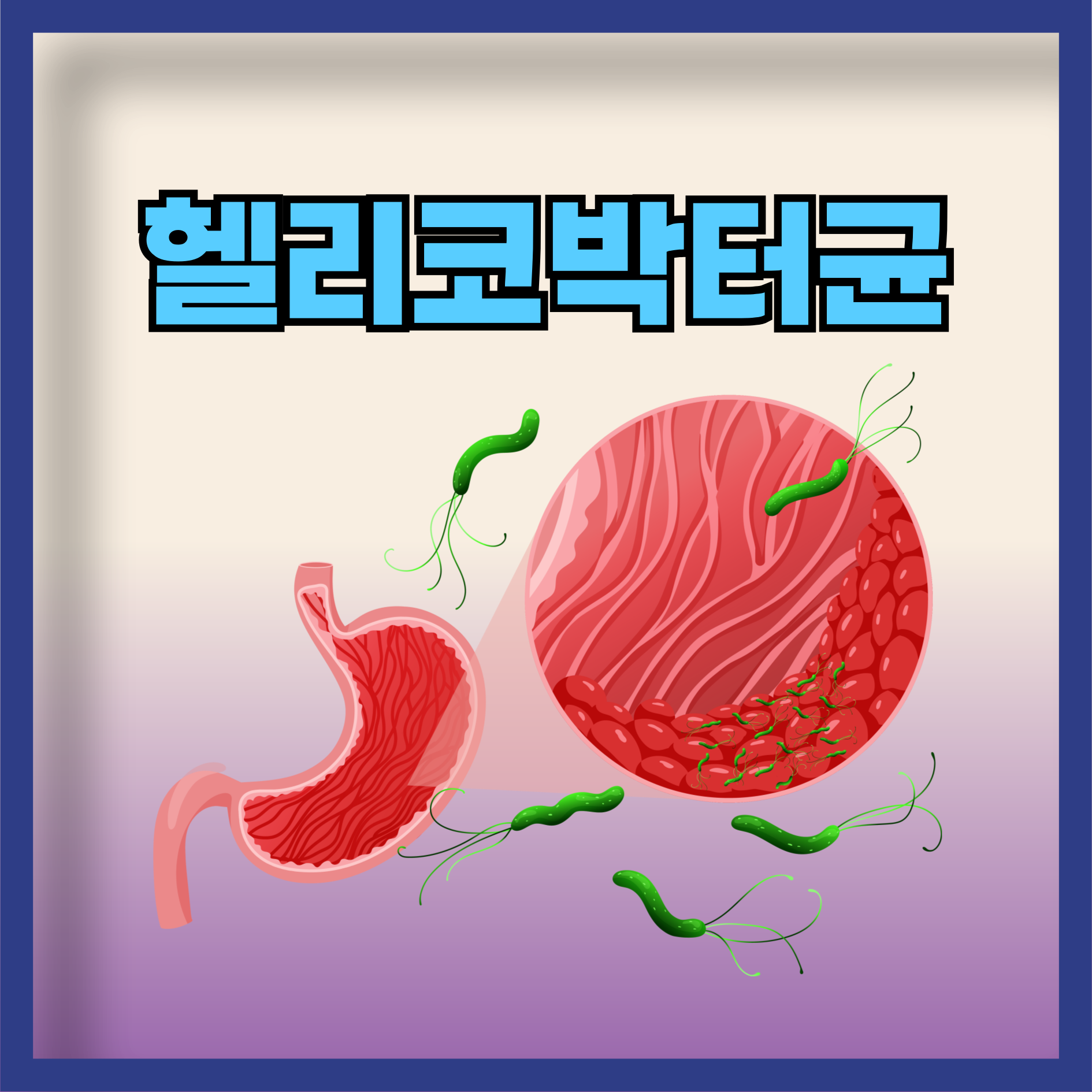 헬리코박터균
