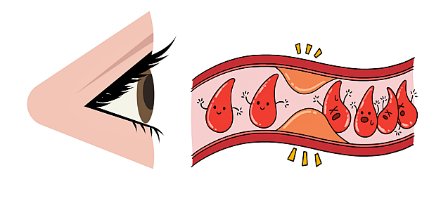 딸기 효능_안토시아닌 효과