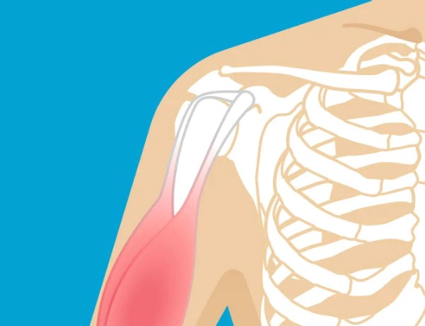 인대 파열 회복기간 및 회복과정 