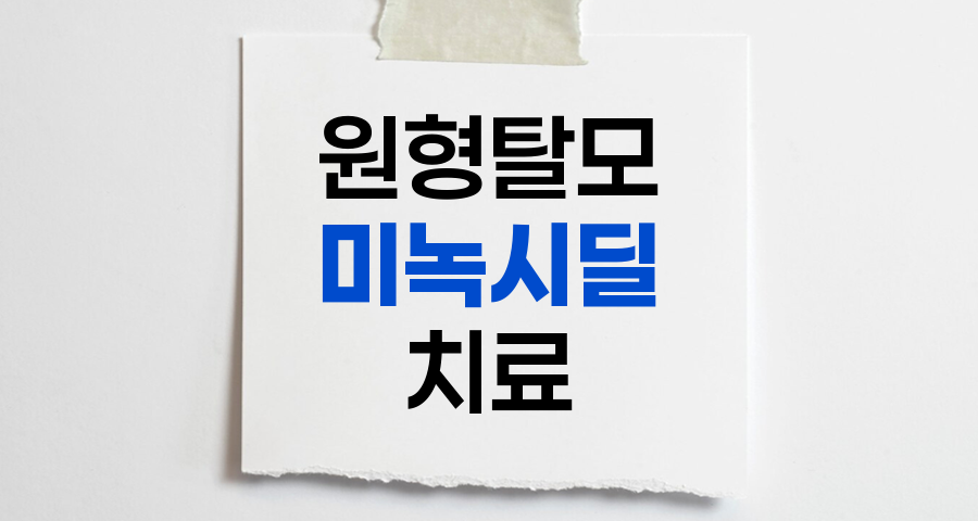 원형 탈모증 미녹시딜 치료법