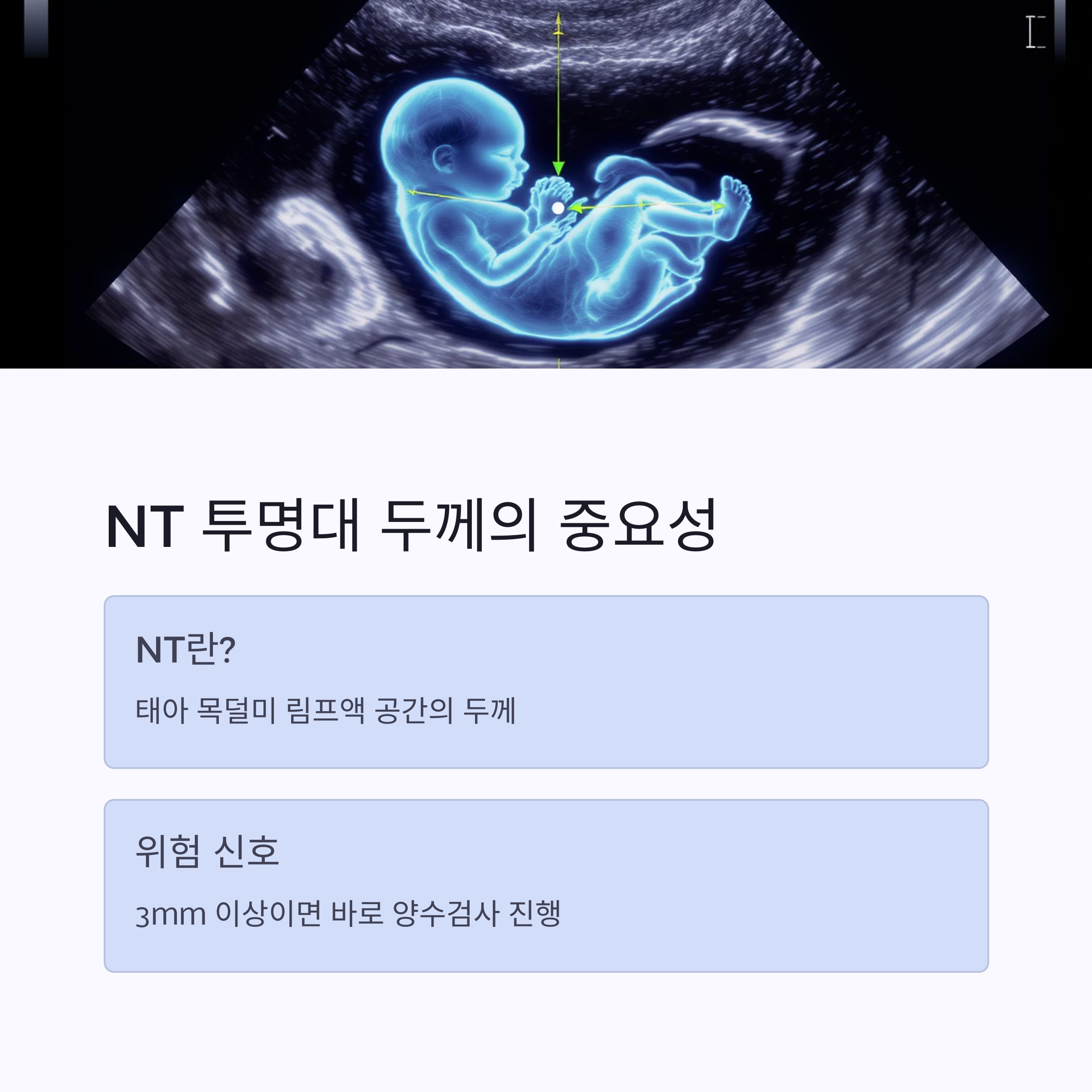 태아의 NT(목덜미 투명대) 두께 측정의 중요성을 설명한 인포그래픽 이미지. NT 정의와 3mm 이상일 경우 양수검사 권장 내용을 포함