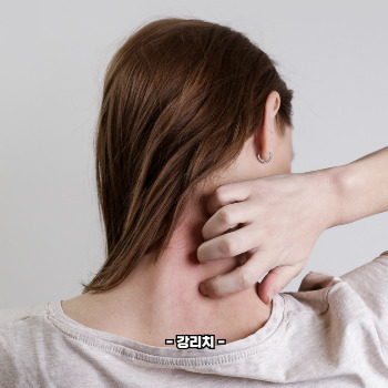 대상포진 치료방법