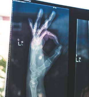 콘드로이친 효능 복용법 시간 부작용