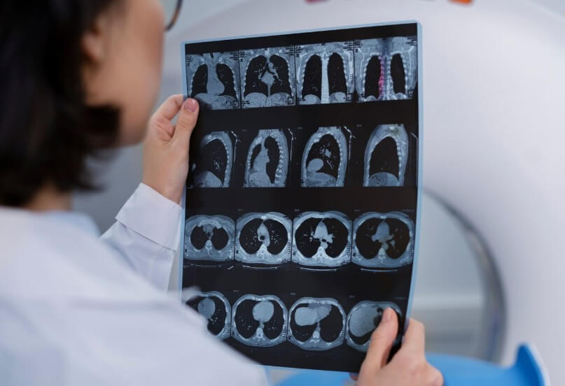 CT 결과를 확인하는 의사