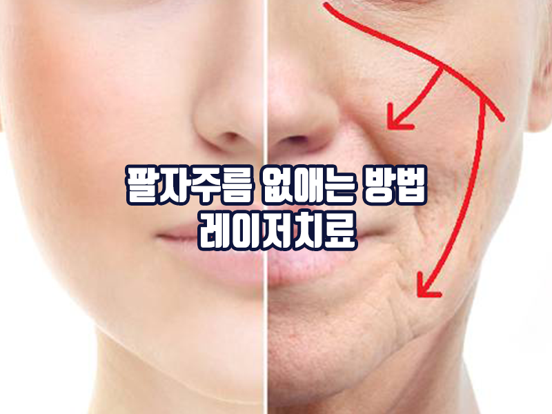 팔자주름 없애는 방법 - 레이저치료