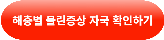 빈대