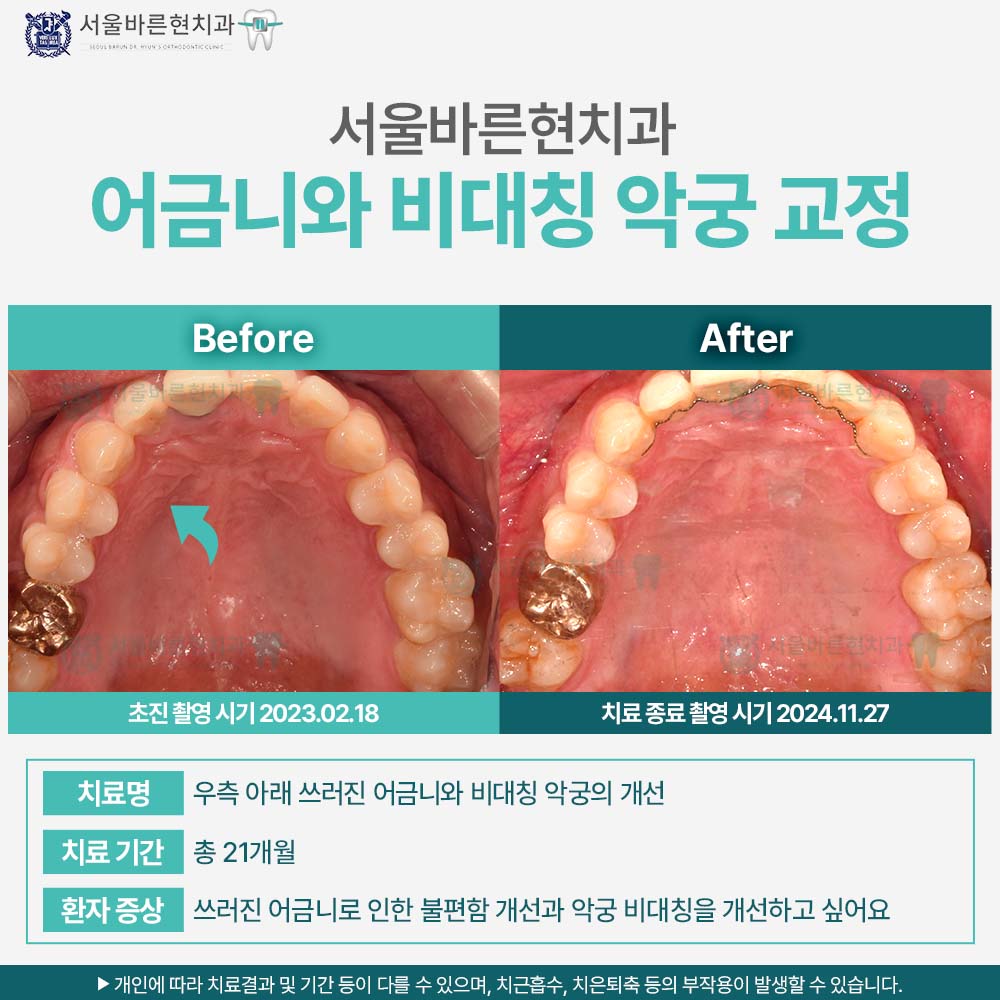 해운대교정치과