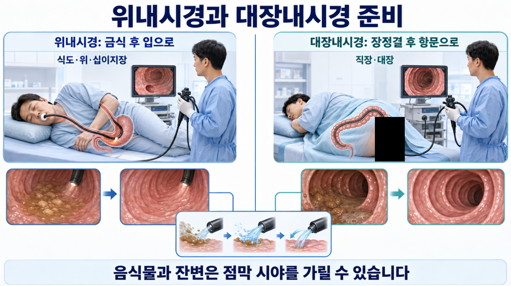위내시경 금식과 대장내시경 장정결 전후의 점막 시야 비교