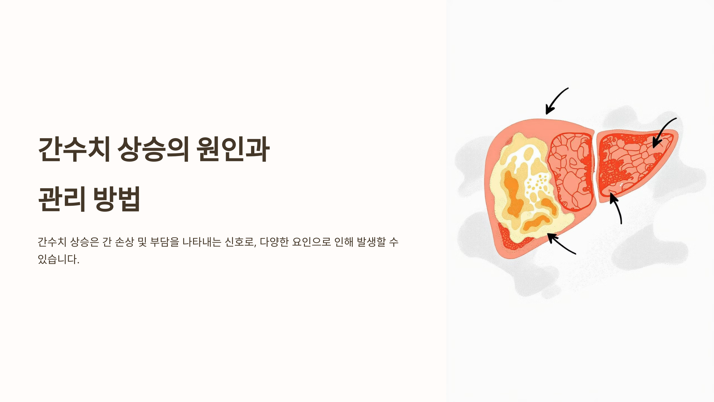 간수치와 관련된 사진입니다.