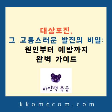 대상포진 포스팅 썸네일