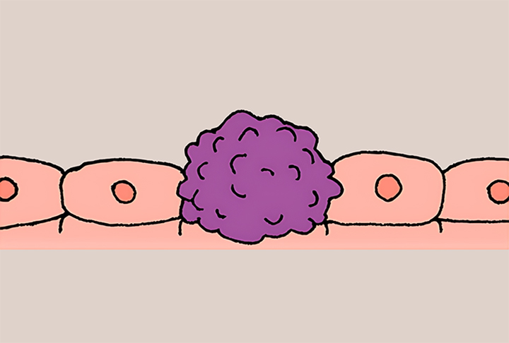 암-예방-효과