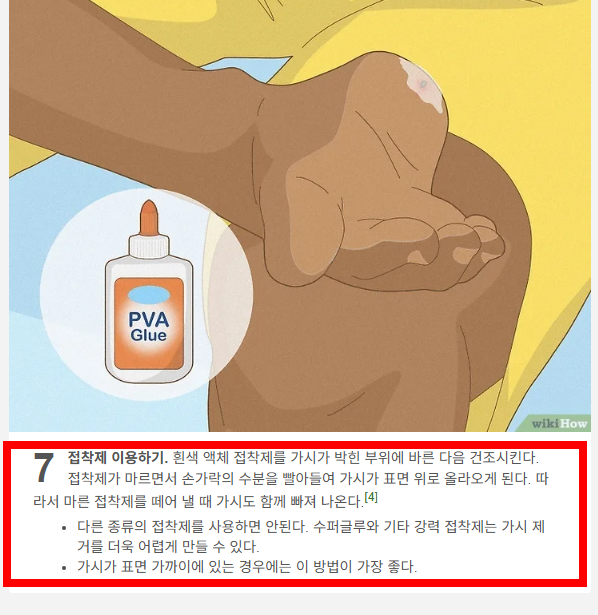 손가락 가시 빼는법 소개