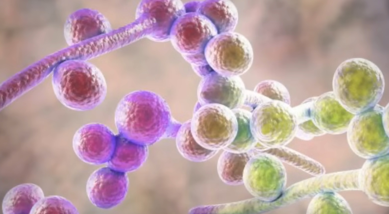 발톱이 검게 변하는 이유