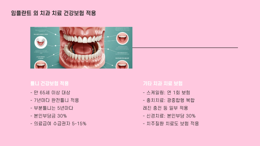 2025년 임플란트 건강보험 적용 기준 – 비용 절감할 수 있는 방법 총정리!