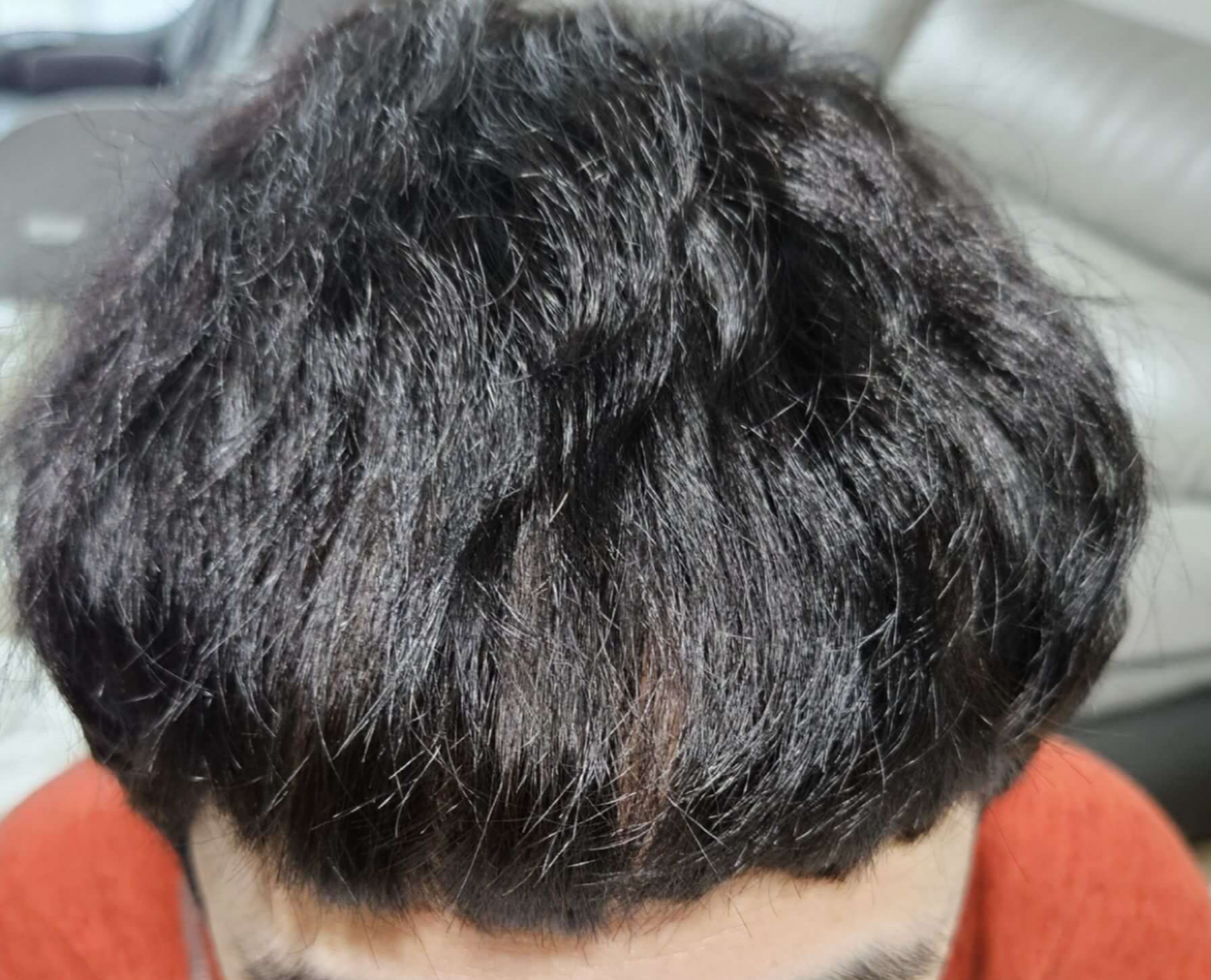 남자 M자탈모 붙임머리