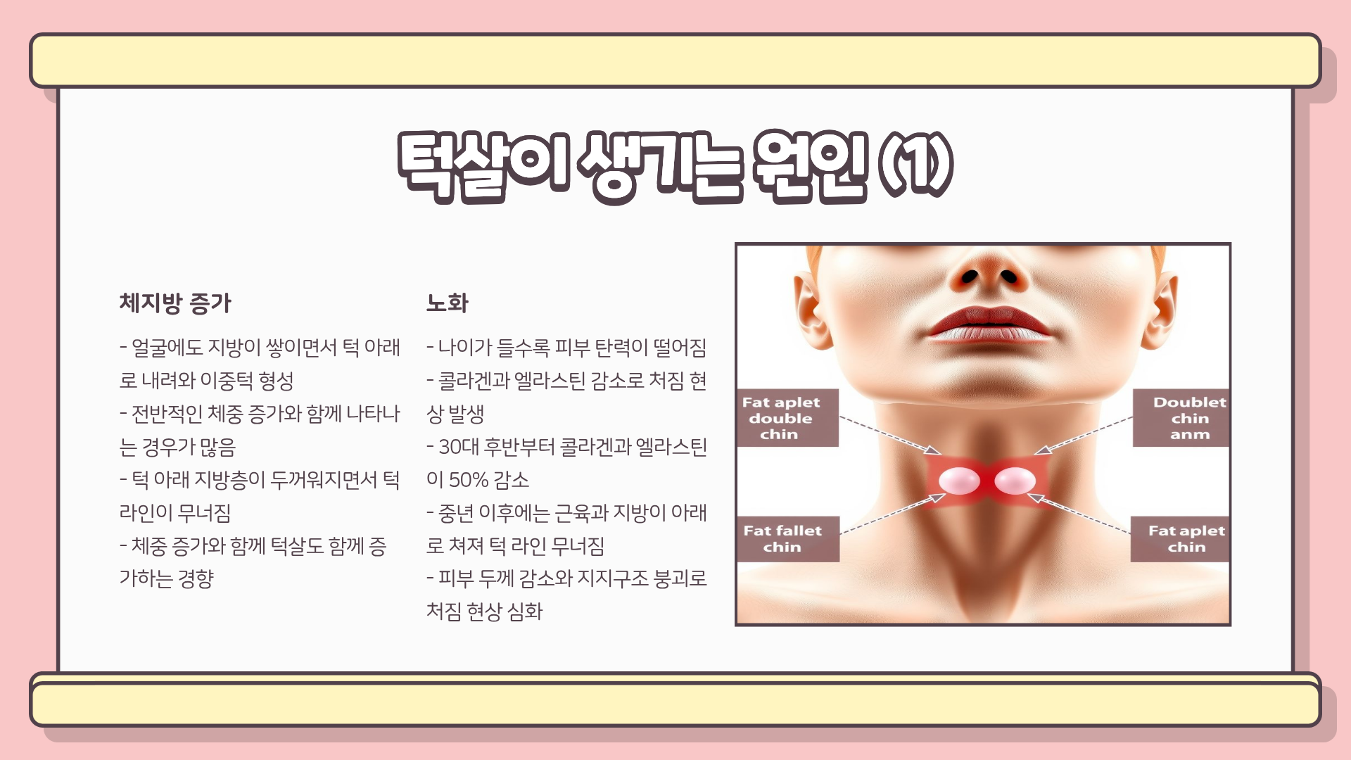 턱살 빼는법, 턱살 없애는 방법, 턱살 리프팅, 턱살 제거까지 총정리