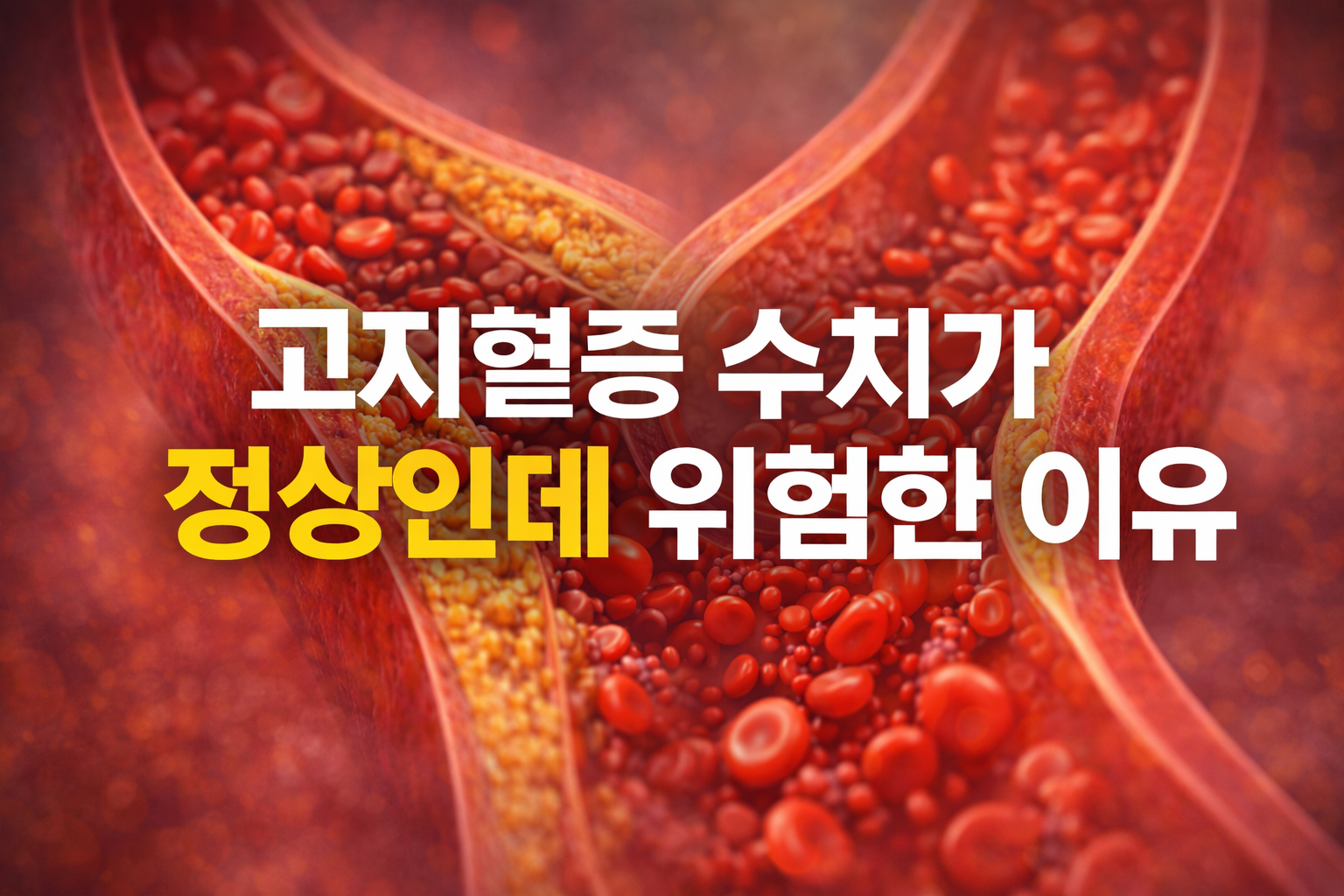 고지혈증 수치 정상인데 위험한 이유