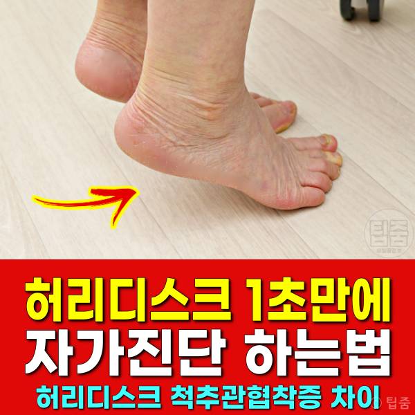 허리디스크 증상 자가진단 까치발