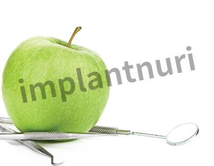 무치악 임플란트는 몇개가 적당한가요