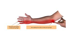 새끼 손가락 저림