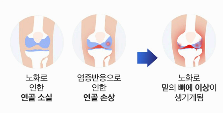 콘드로이친 효능 사진