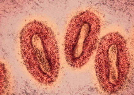 아데노 바이러스