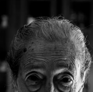 황반변성 증상 원인 치료법