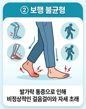 두꺼운 발톱