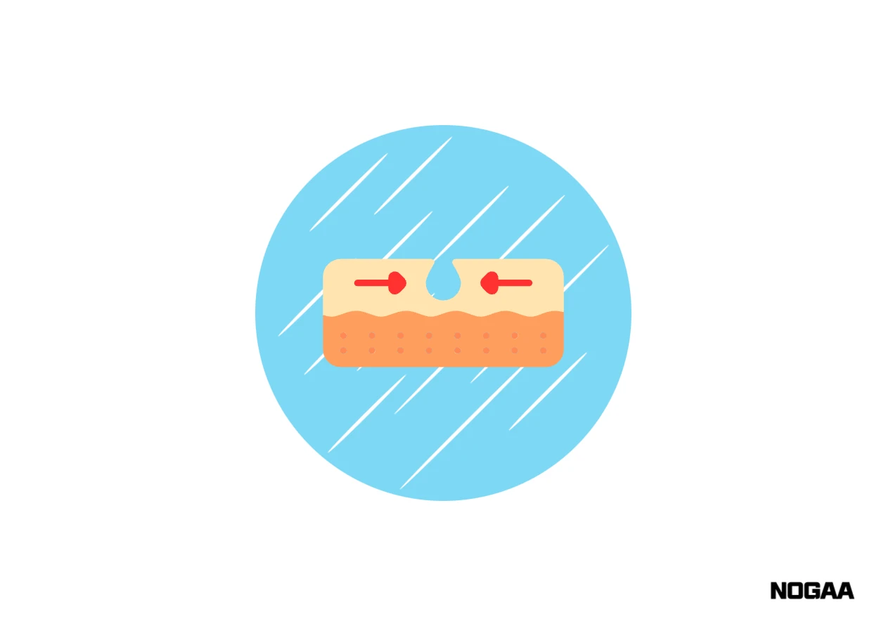 모공각화증 치료 방법