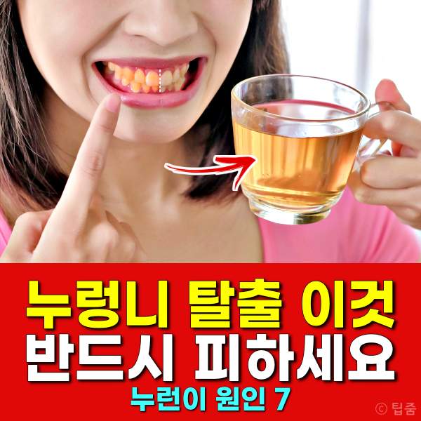 누렁니 탈출,누렁니 원인 음식,누런이 원인,팁줌