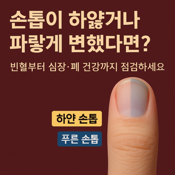 손톱의 색깔이 변했다면/gpt
