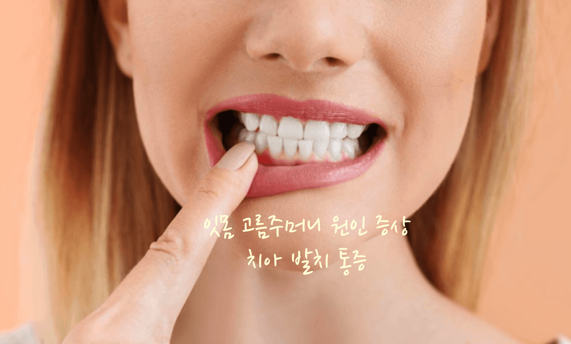 잇몸 고름주머니