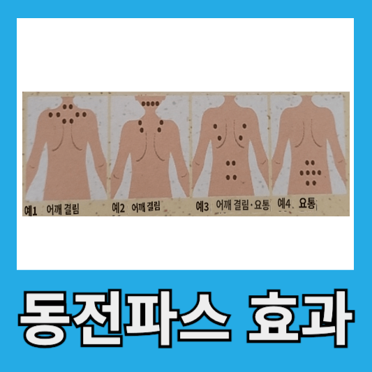 동전파스 효과
