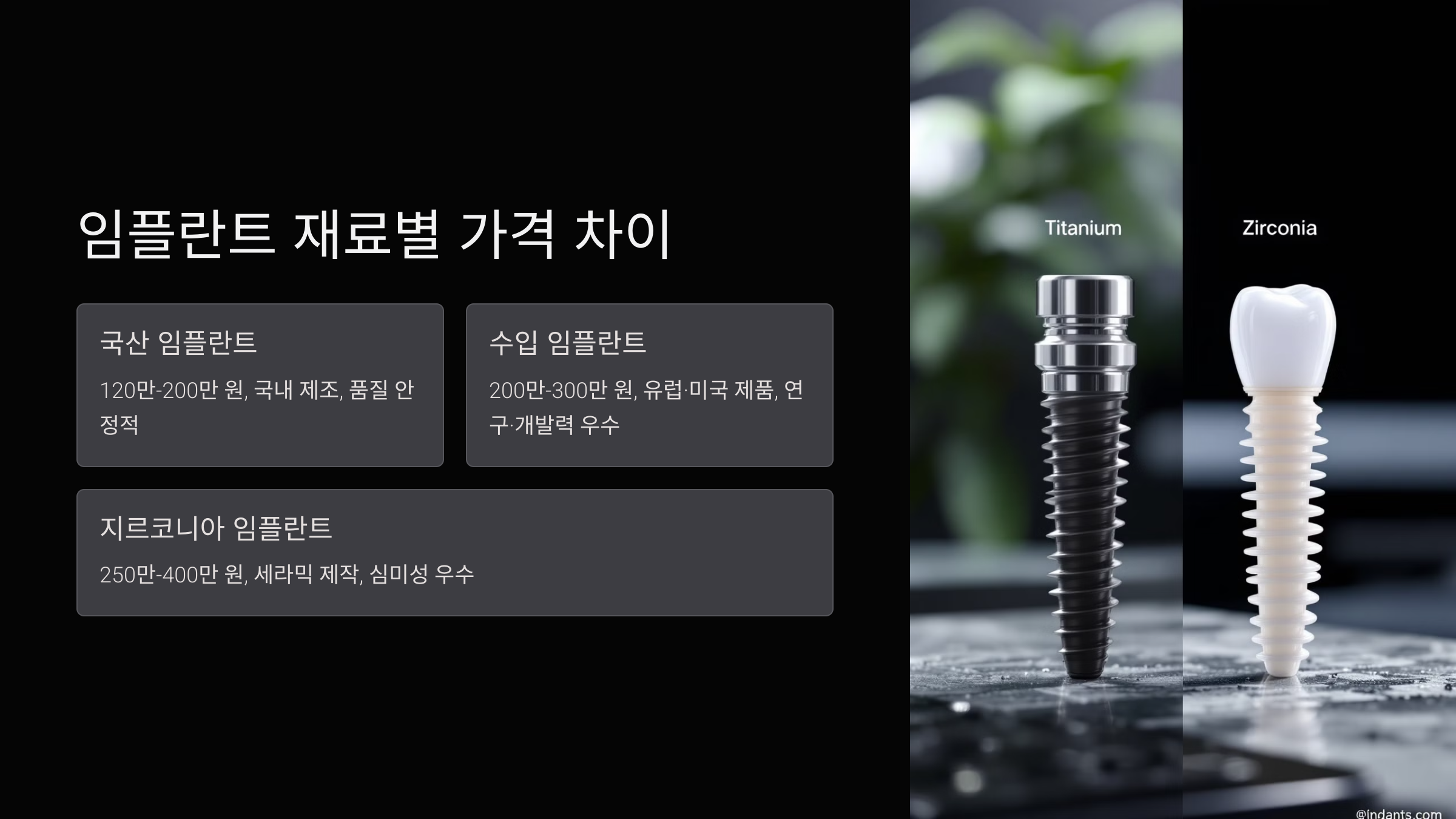 임플란트 재료별 가격 차이