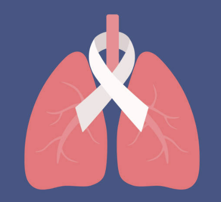 폐암 초기증상&amp;#44; 폐암에 좋은 음식 알아보기!