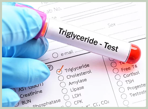 중성지방 수치 테스트