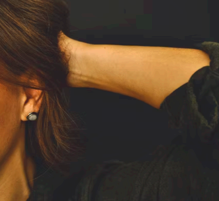 돌발성 난청 원인 