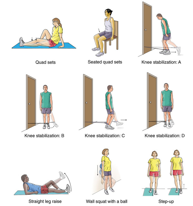 후방십자인대 재건술 후 재활