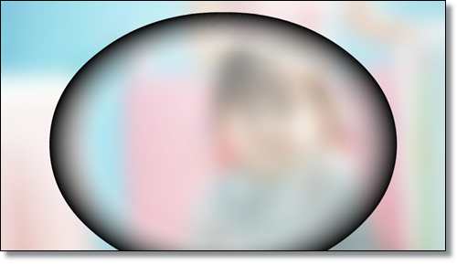 망막전막-유리체절제술-후기-과정-비용