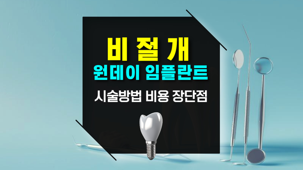 비절개 당일 원데이 임플란트 식립 시술방법 비용 및 장단점