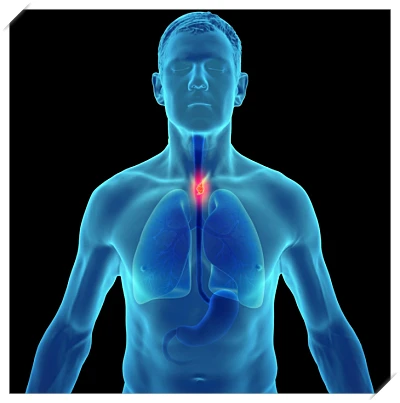 식도염 좋은 음식