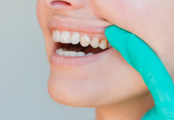 잇몸이 붓고 아픈 이유